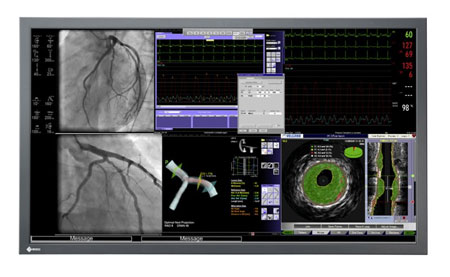  Eizo RadiForce LS560W